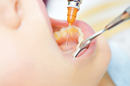 Dentista: Paura dell'anestesia locale? Uno spray sostituirà le iniezioni