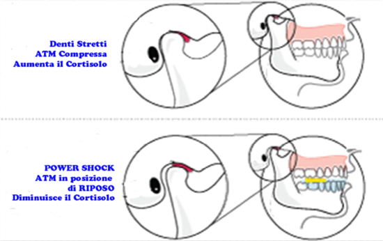 dossier gnatologia sportiva