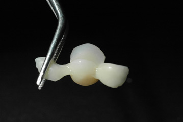 osso alveolare - foto 7
