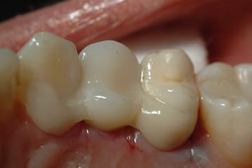 osso alveolare - foto 9