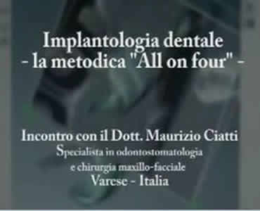Implantologia dentale con metodica All on 4