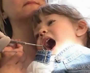Ozonoterapia bambini