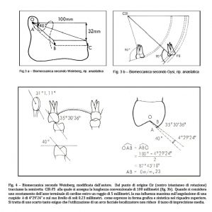 Molaggio selettivo: Figura 3 - 3b e Figura 4