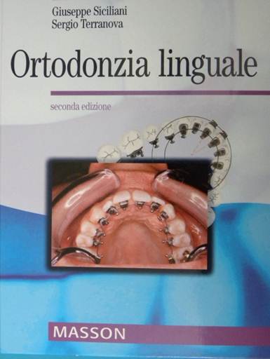 Ortodonzia linguale