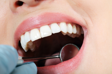 Autotrapianti dentali: ... eppure gli anni passano, ma i denti restano.