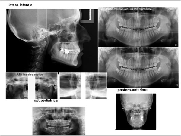 Lo studio del caso ortodontico