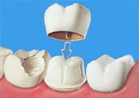 Estetica dentale - parte 2^
