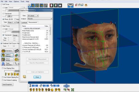 cefalometria 3D DOLPHIN imaging