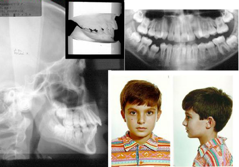 Analisi preliminari, diagnosi preliminare, predizione di crescita