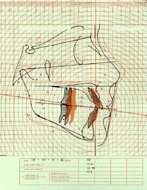 Analisi preliminari, diagnosi preliminare, predizione di crescita