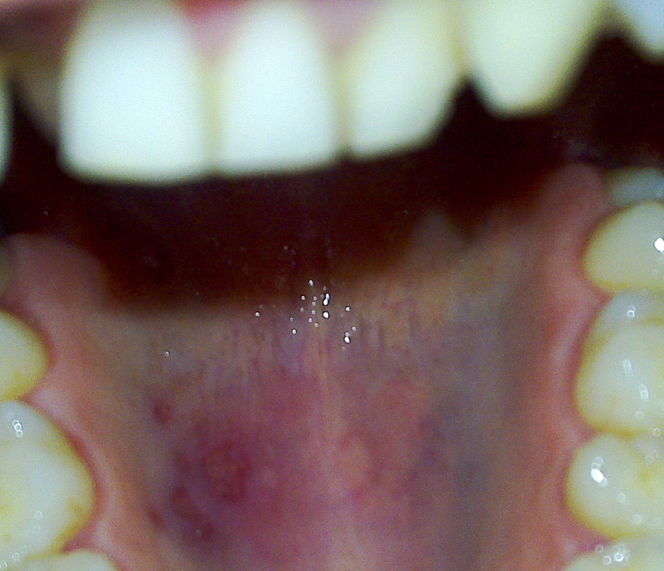 08112010576.jpg