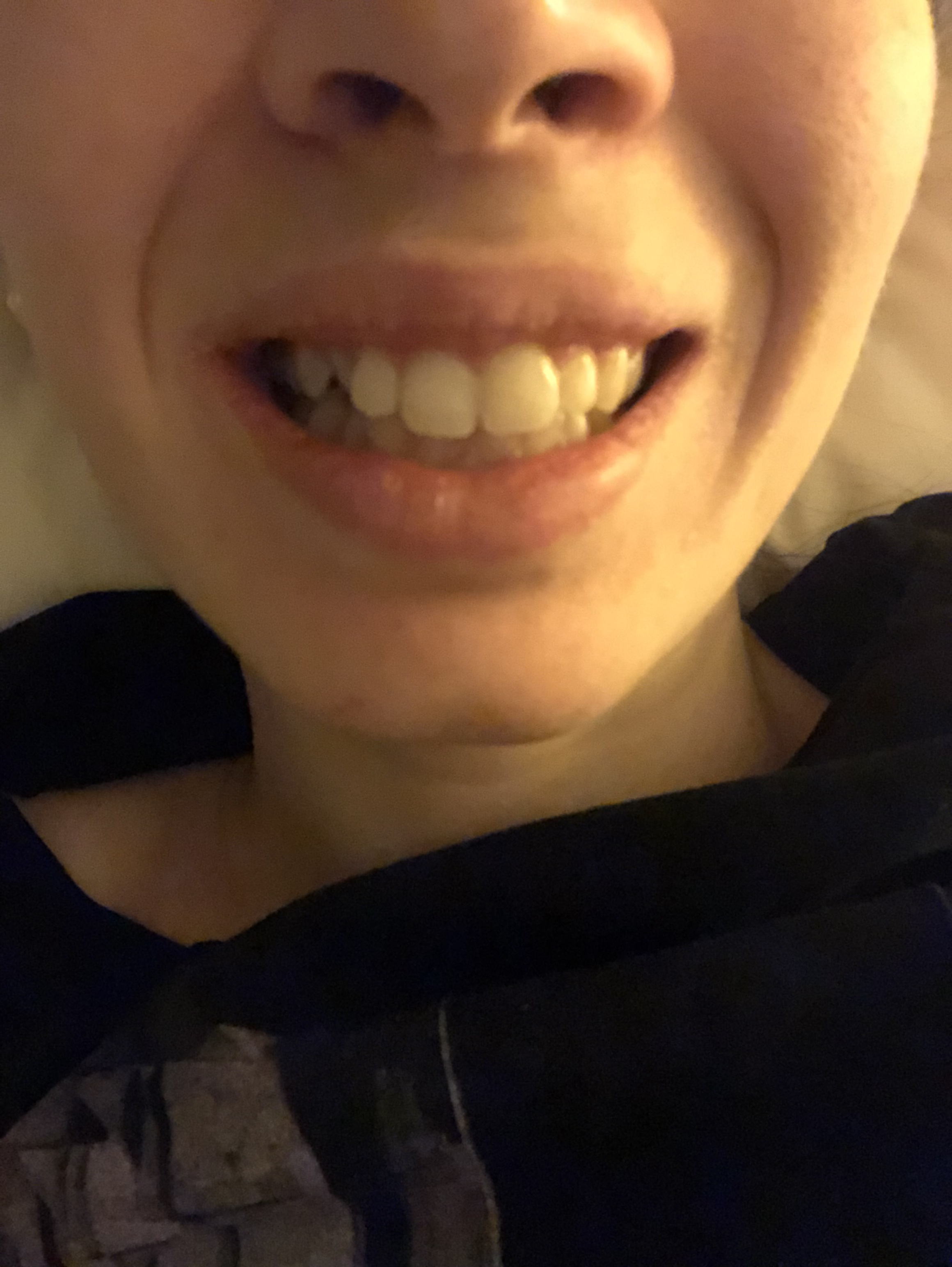 E' possibile cambiare dentista durante il percorso di un apparecchio?