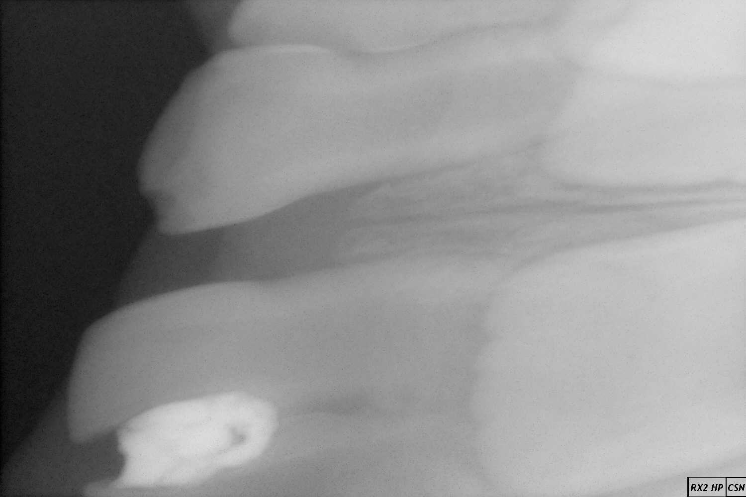 2016-10-06_radiografia-dente_a.jpg