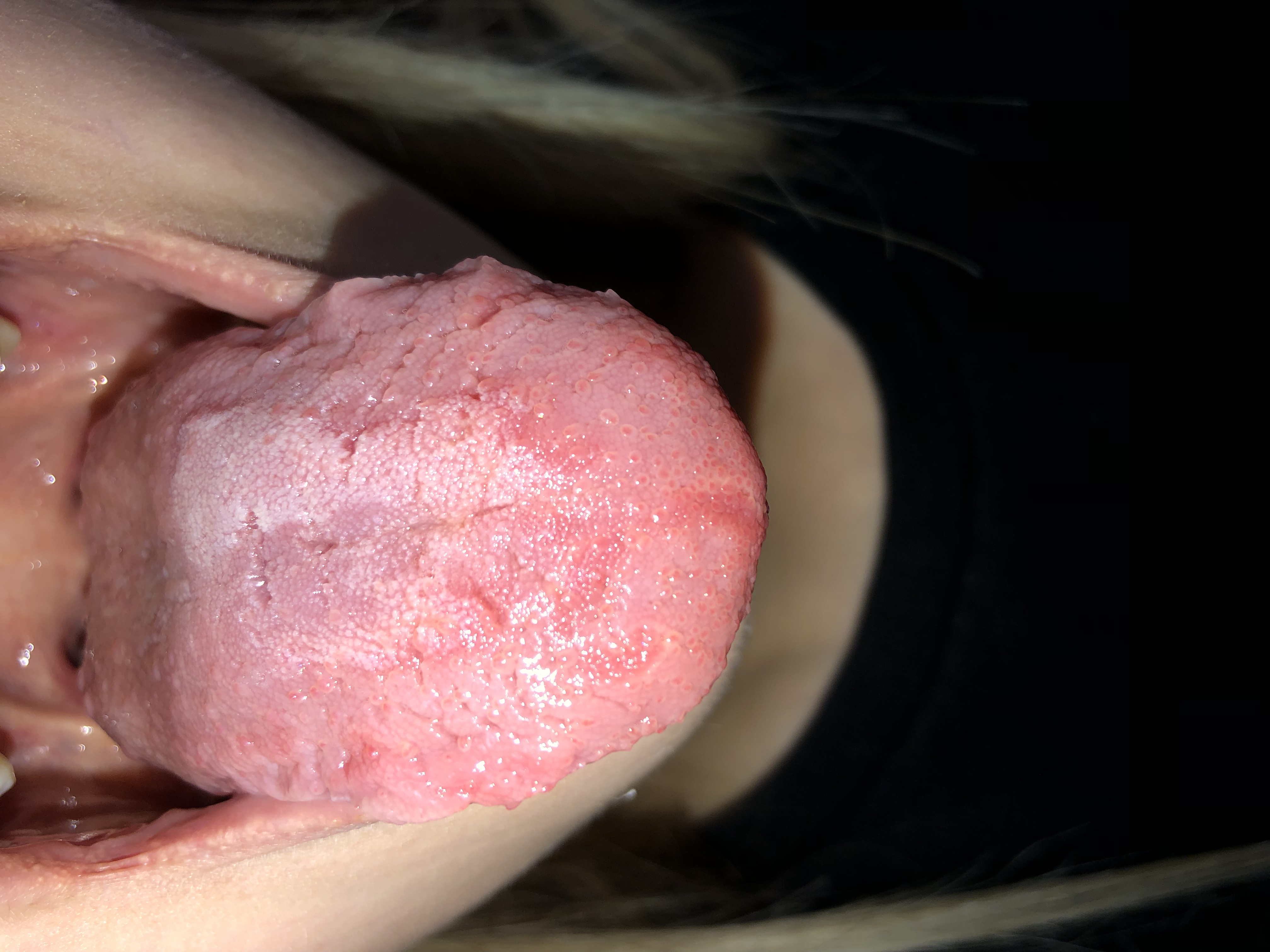 Lingua con puntini bianchi e rossi da due settimane