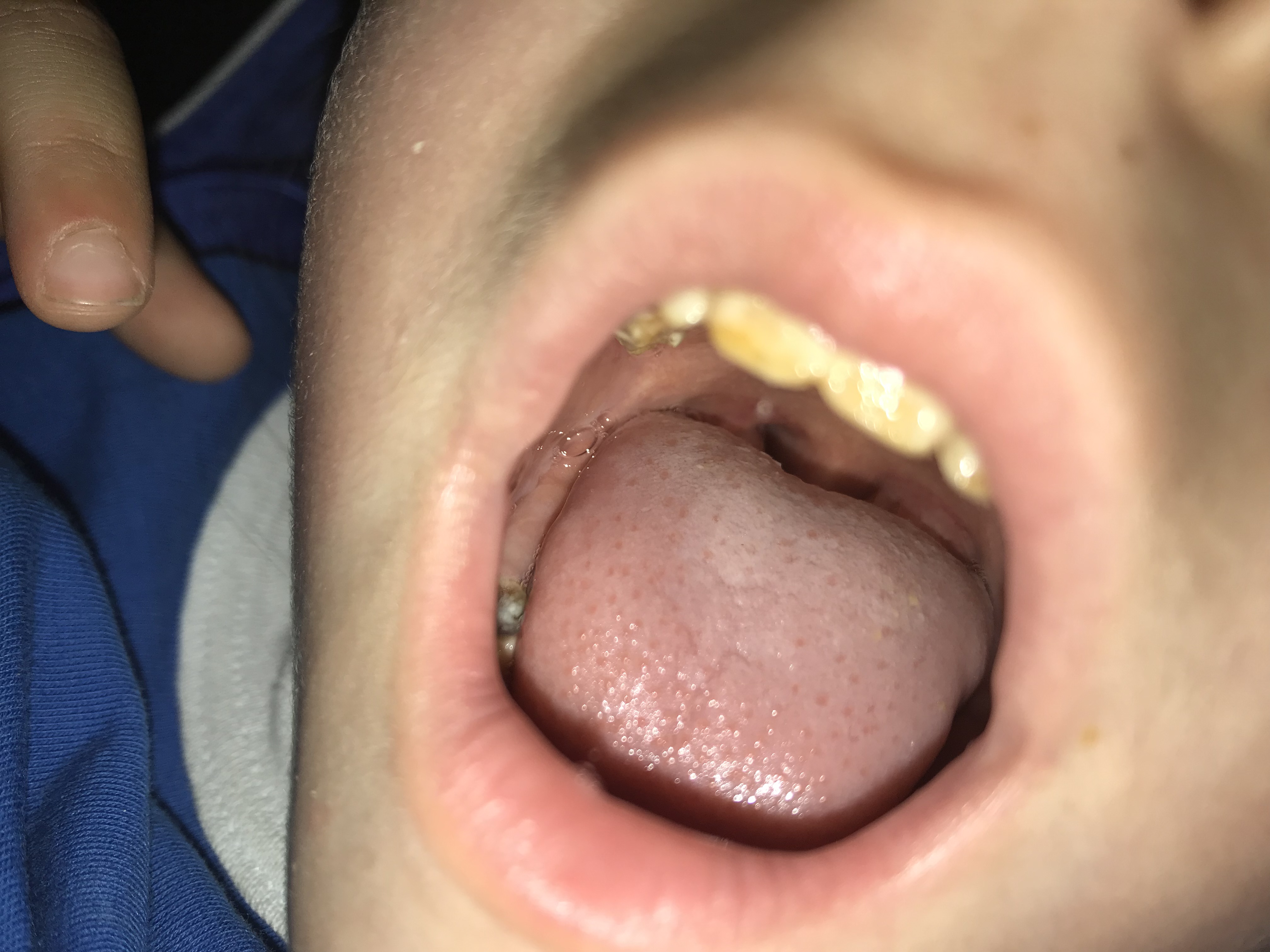 La mia bambina soffre di una patologia che coinvolge lo smalto dentale