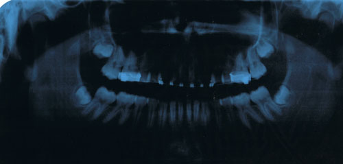CCF17072010.jpg