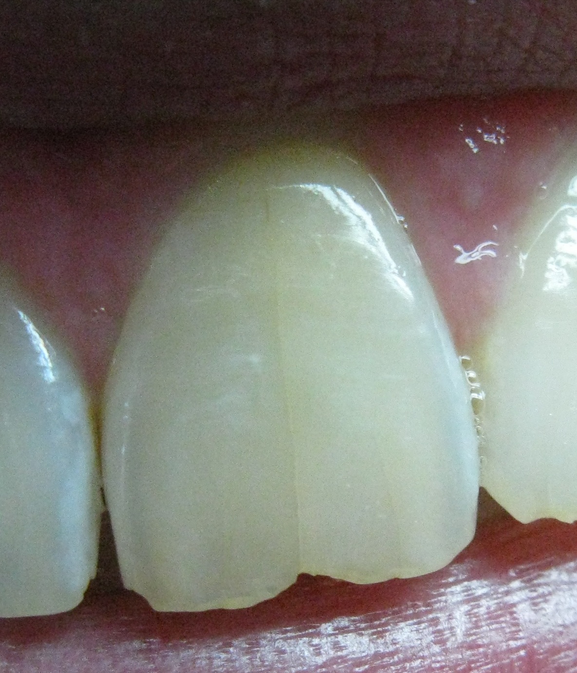 Dente.JPG