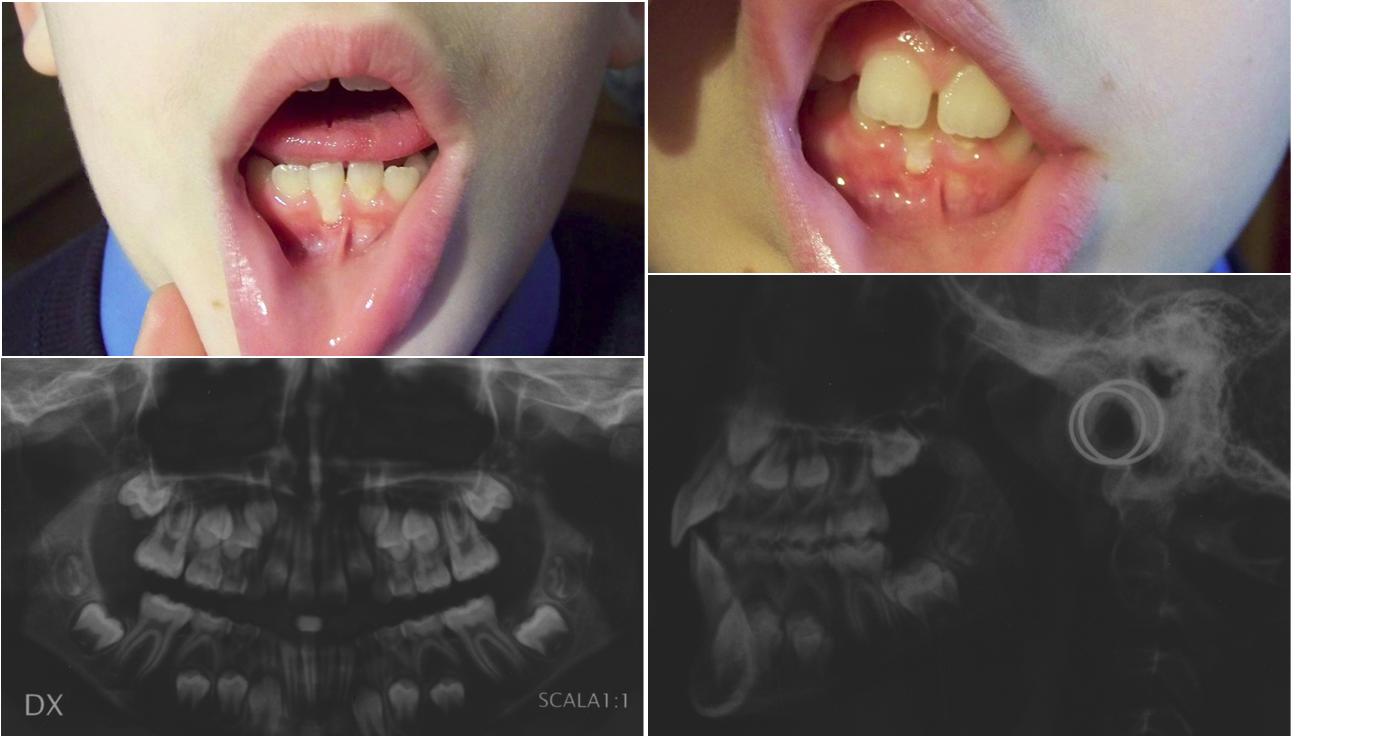 FOTO-DENTI.JPG