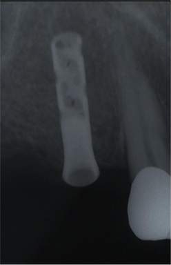 Implantologia-SM.jpg