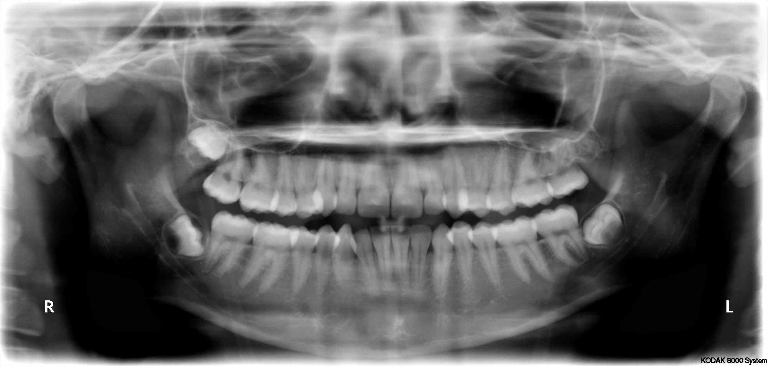 PANORAMICA-DENTARIA.jpg