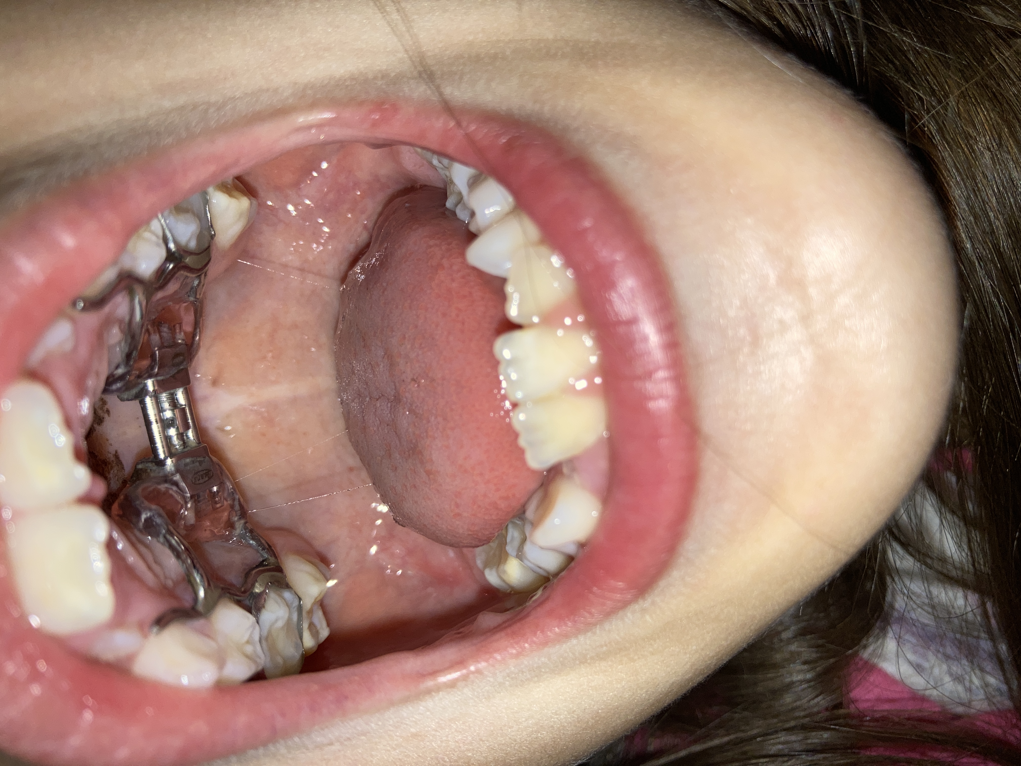Bimba di 7 anni con diversi problemi ai denti