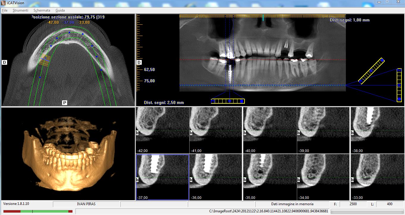 dental-scan-scala1-.jpg