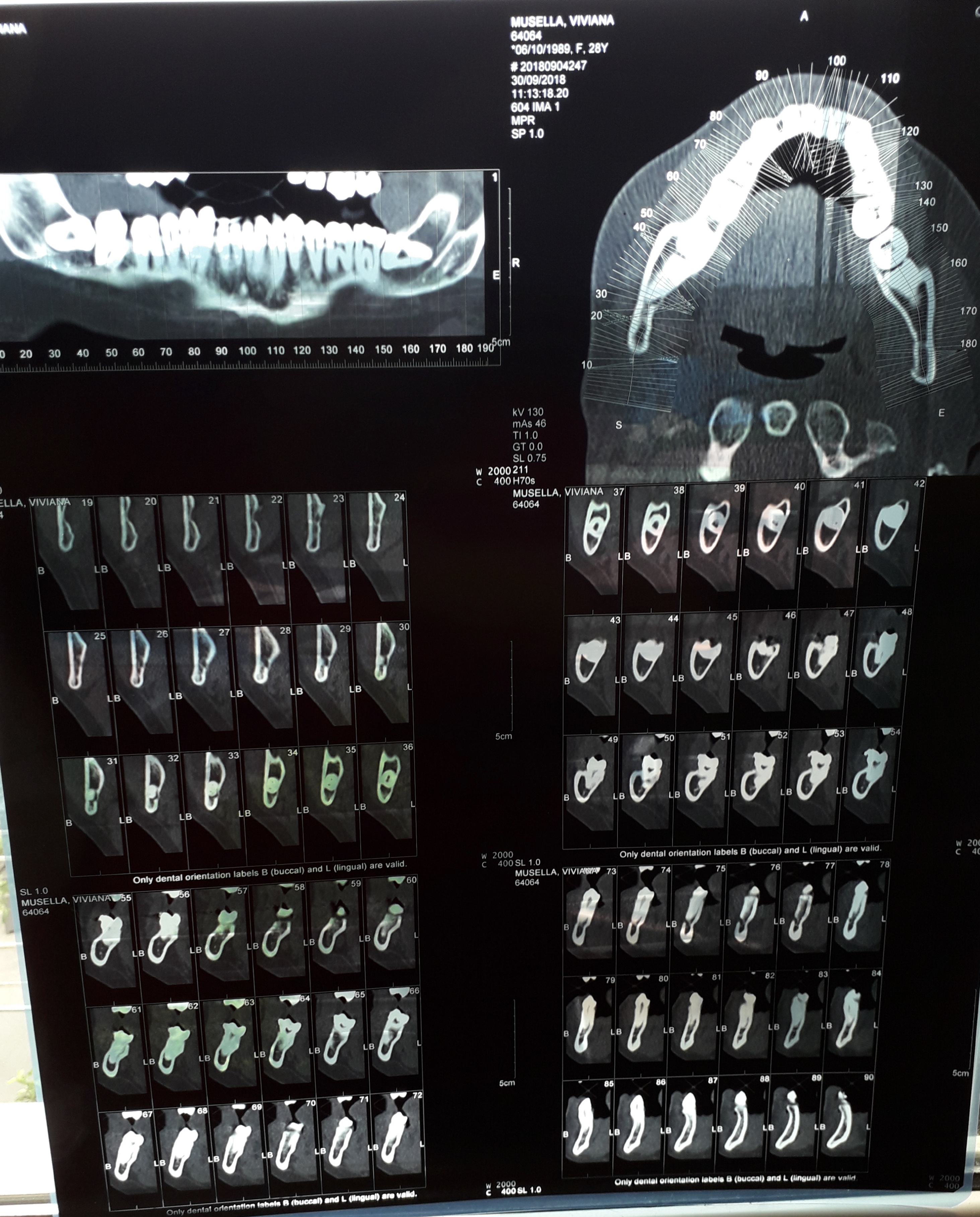 dentalscan.jpg