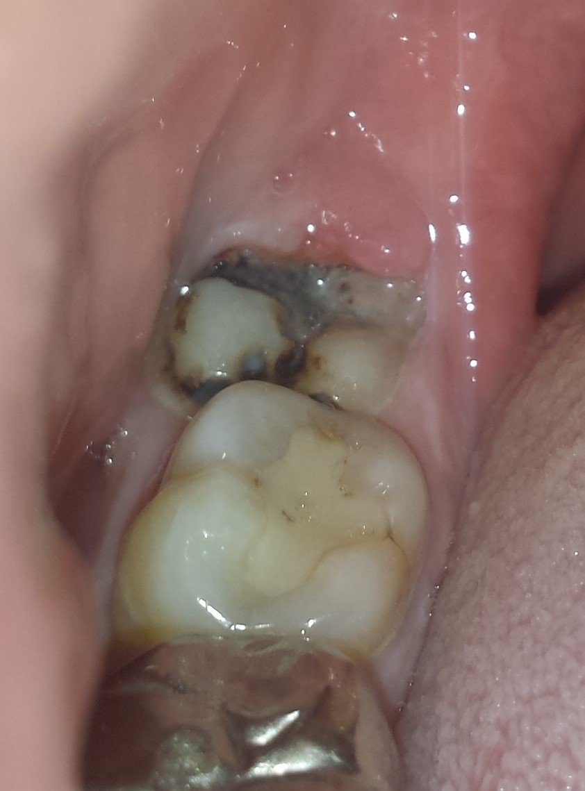 dente-(2).jpg