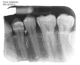 dente.png