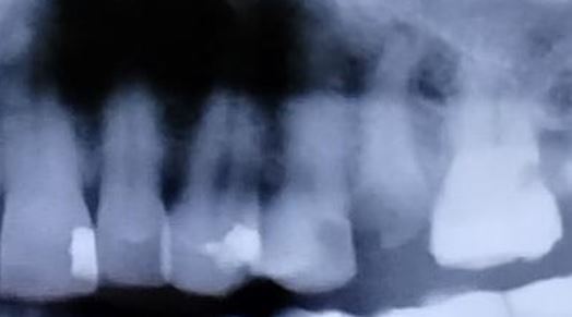 dente_25.jpg