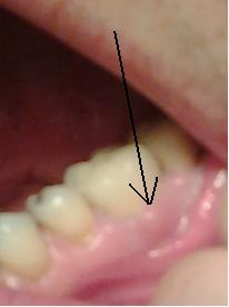 dente_allegato.jpg