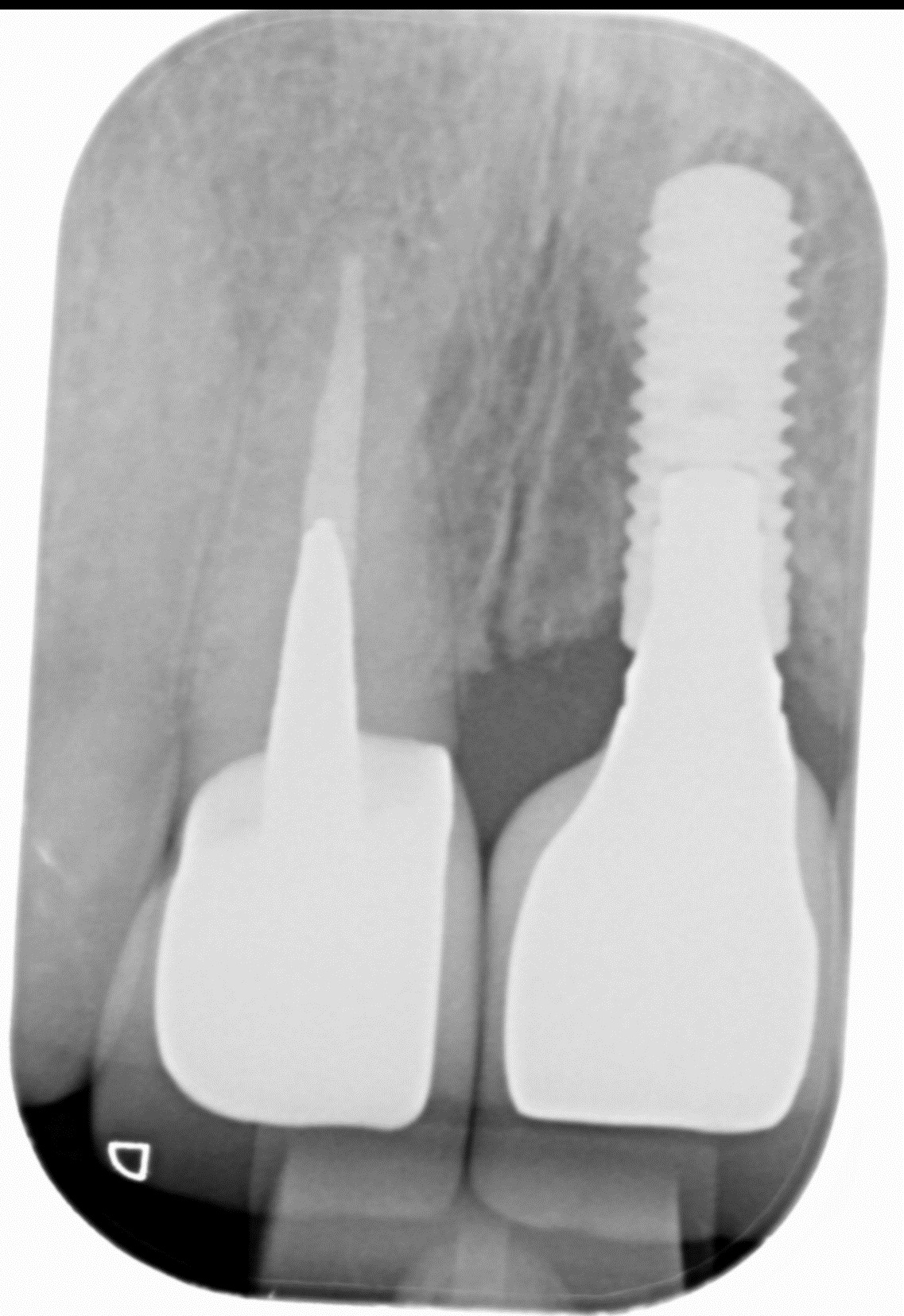 denti---11.jpg