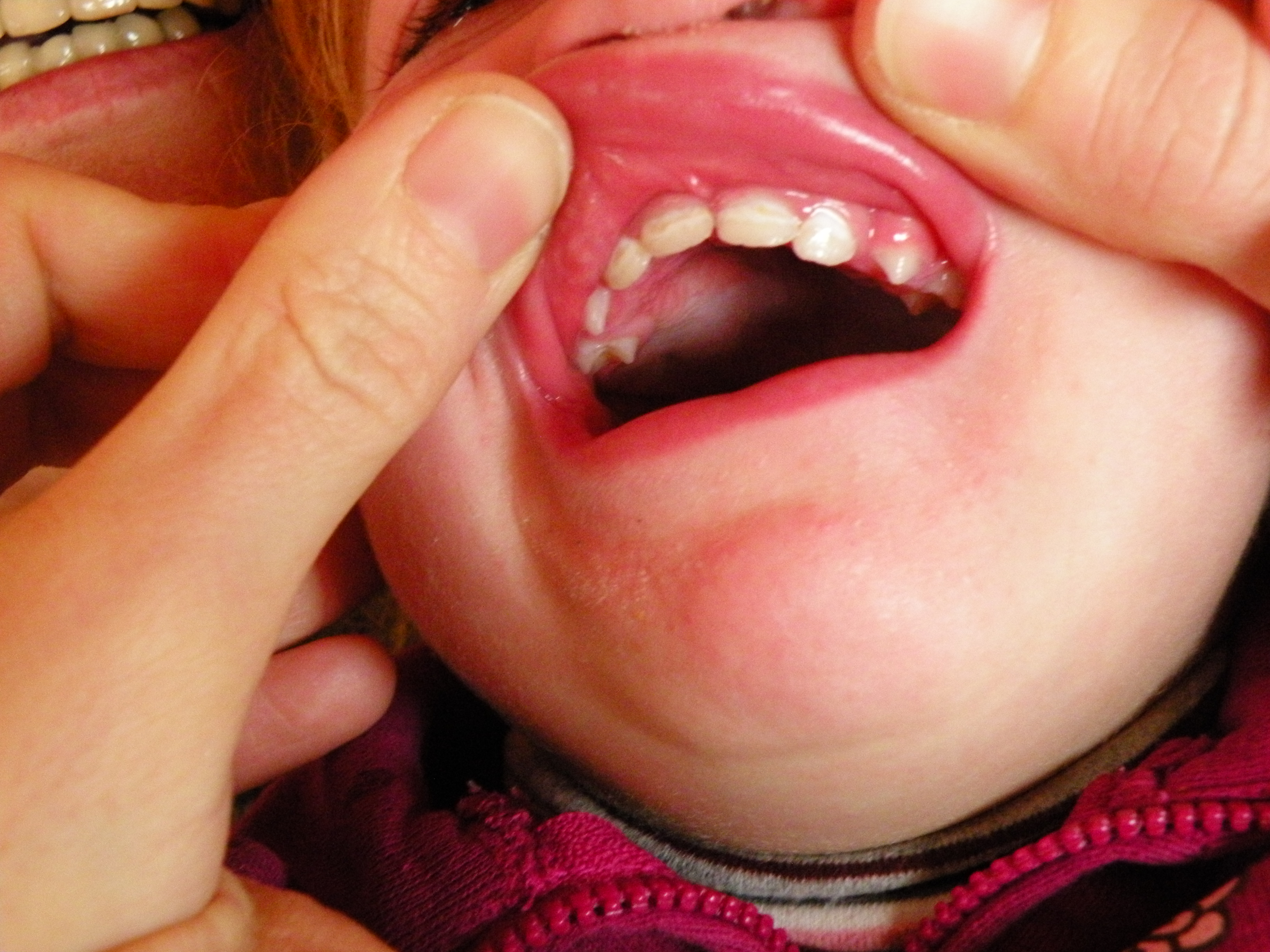 denti-di-Sofia.JPG