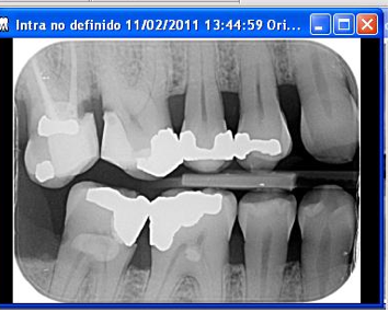 denti-marco-ds.png