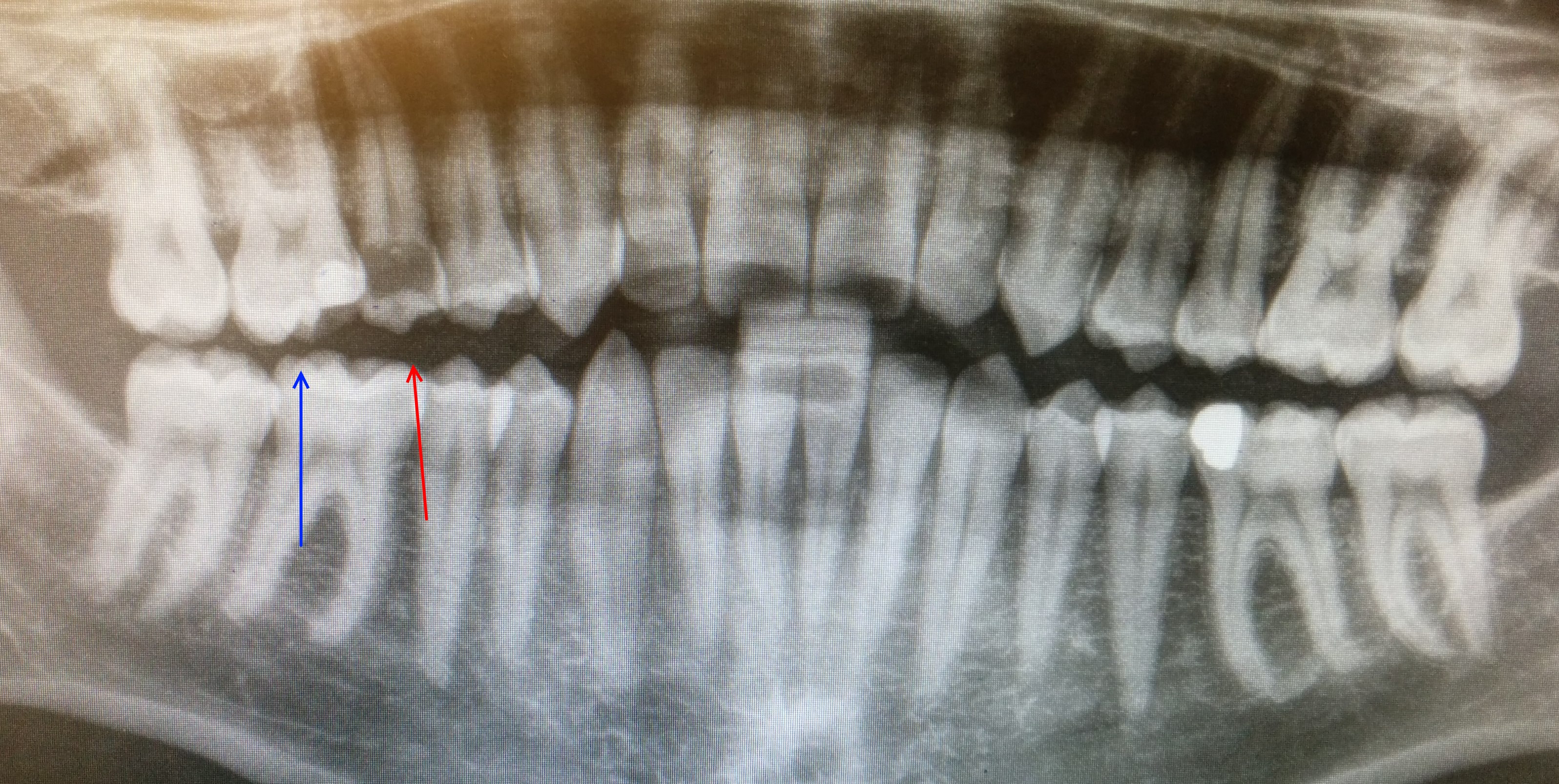 denti250516.jpg