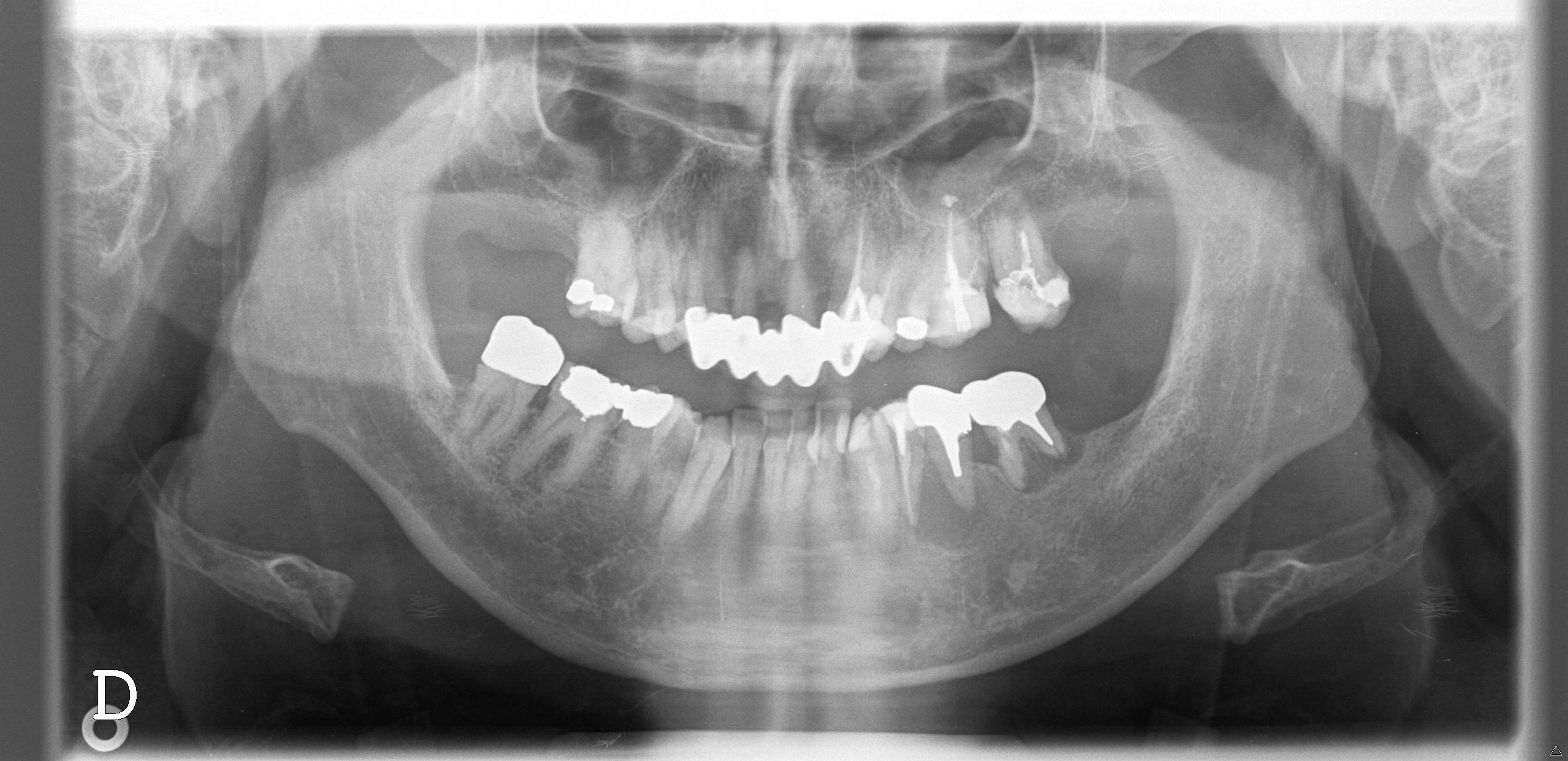 dentifabio.jpg