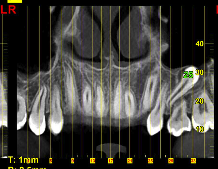 dett-dent-incluso.jpg