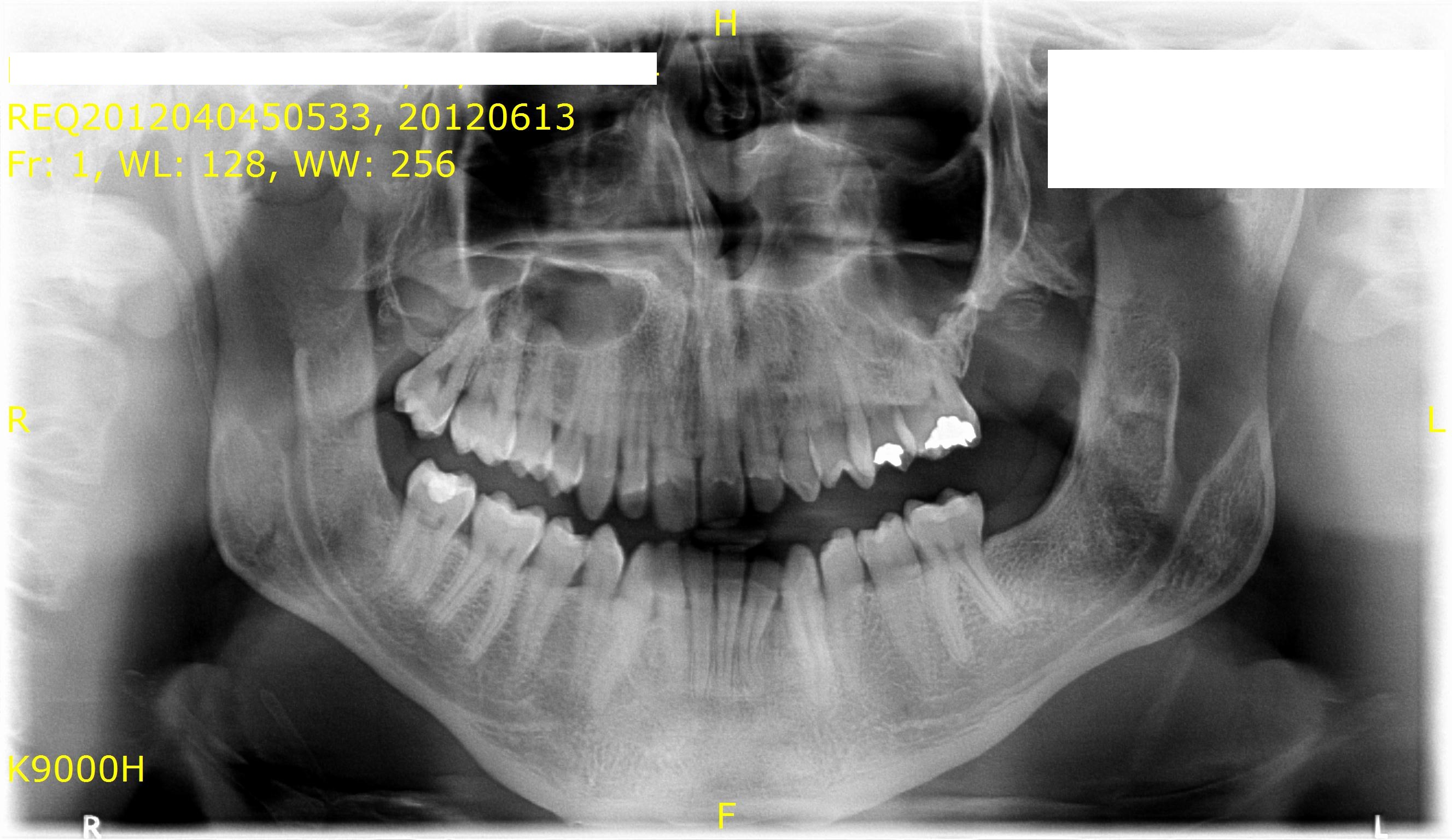 dicom-0000b11f.jpg