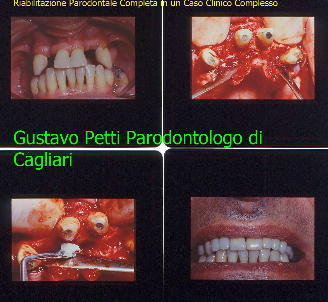 dr.g.petti-parodontologia-riabilitazione-194-.jpg