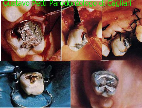 dr.gustavo-petti--parodontologo-cagliari-115.jpg