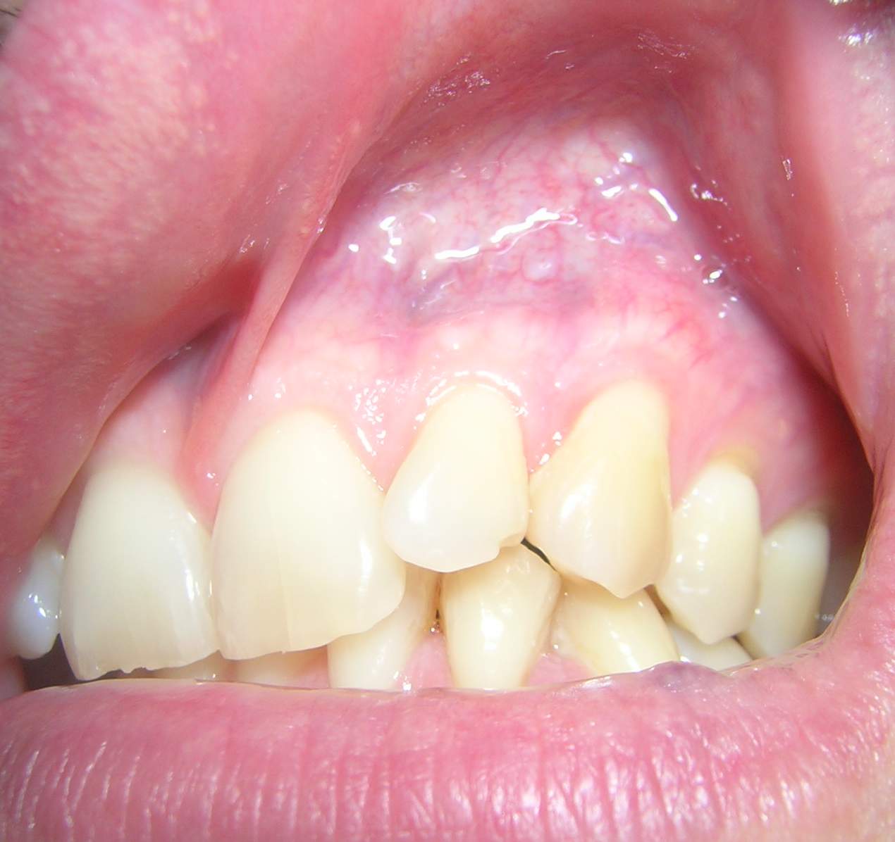 dscn3256_1.jpg