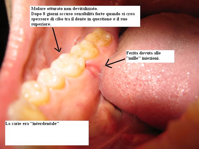 ferita-gengivale1.JPG