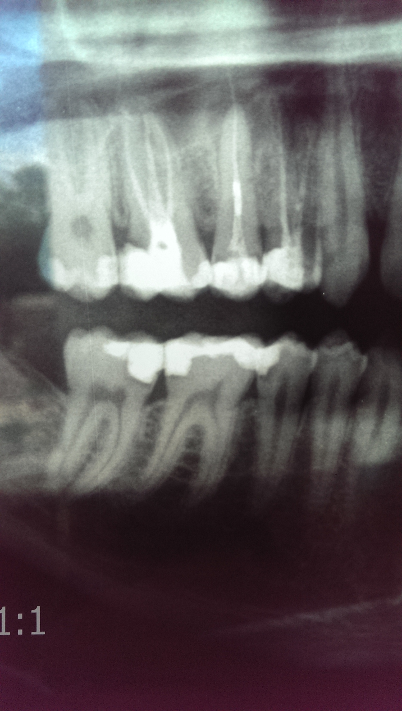 Il mio dentista dice che sarei cario recettivo con una materia dentale estremamente fragile