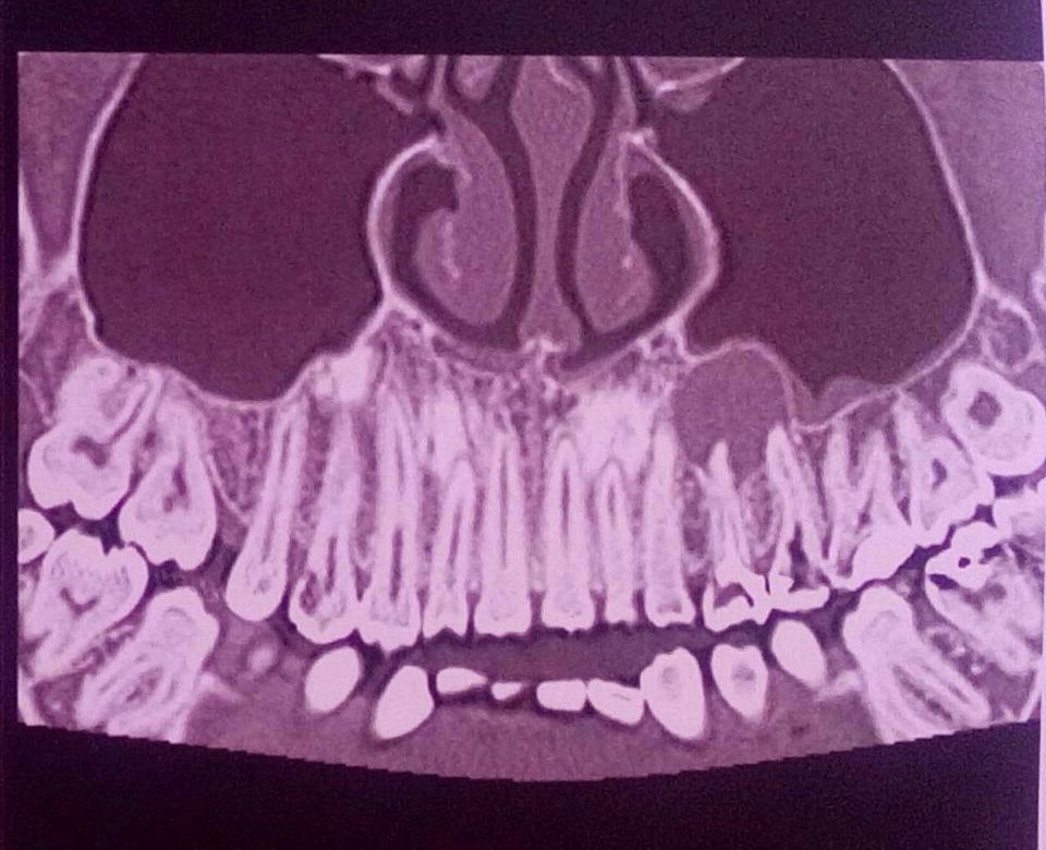 C'Ã¨ modo di salvare i denti?