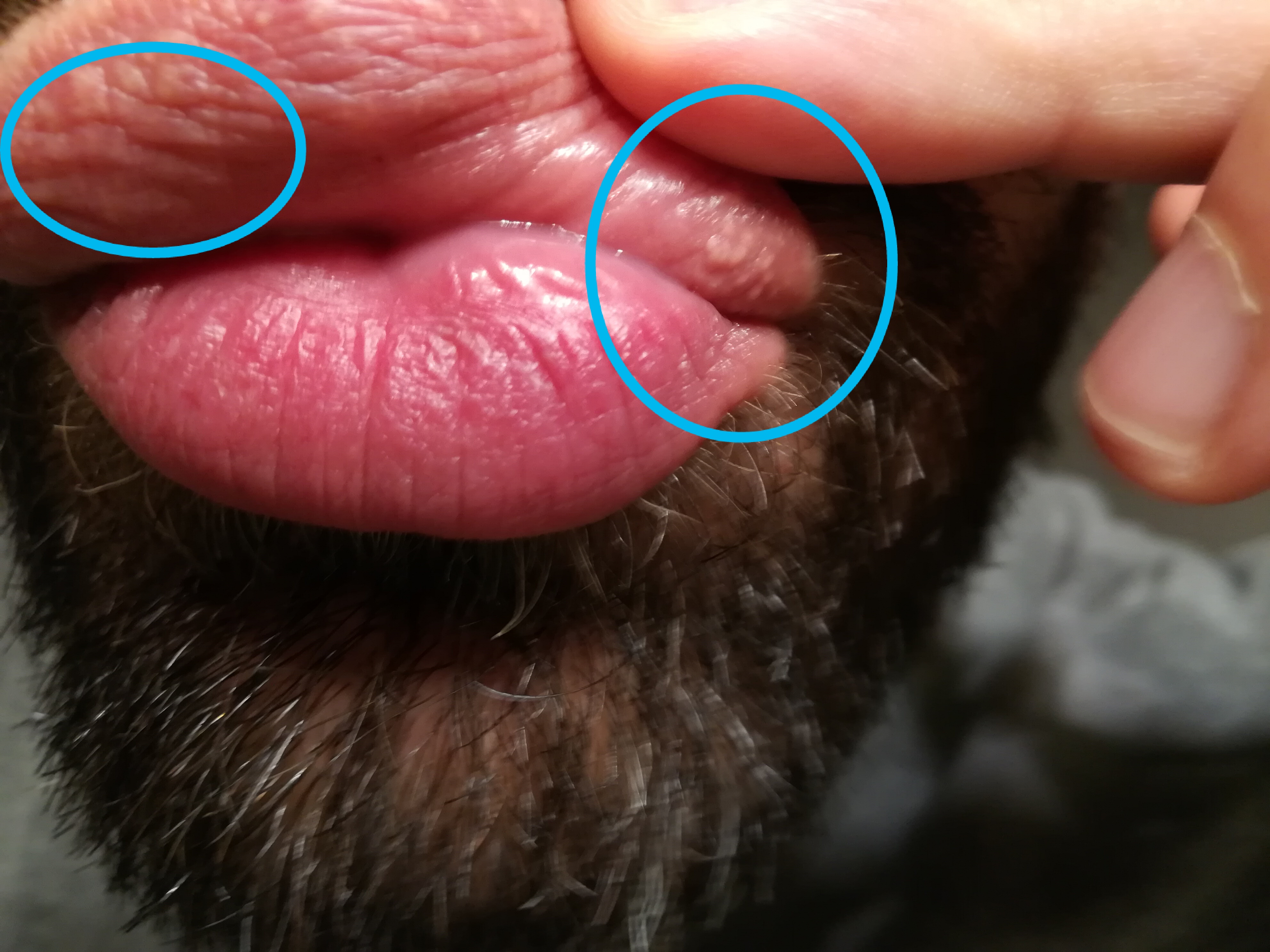 papilloma virus sulle labbra della bocca