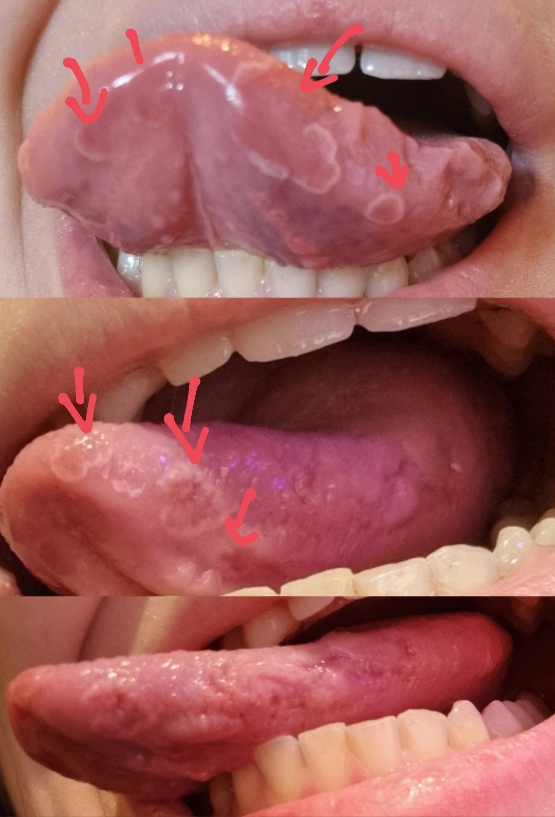 C'Ã¨ qualcosa che posso fare per proteggere anche di piÃ¹ la lingua dai denti?