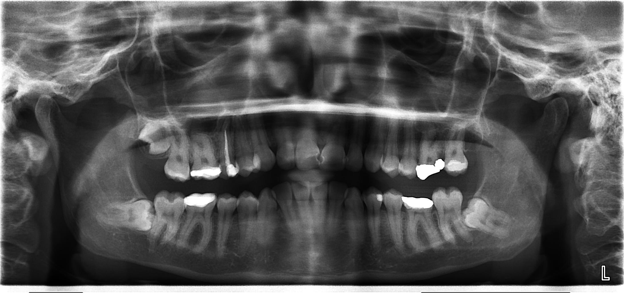 La mia situazione dentale  è complessa e vorrei il Vostro parere