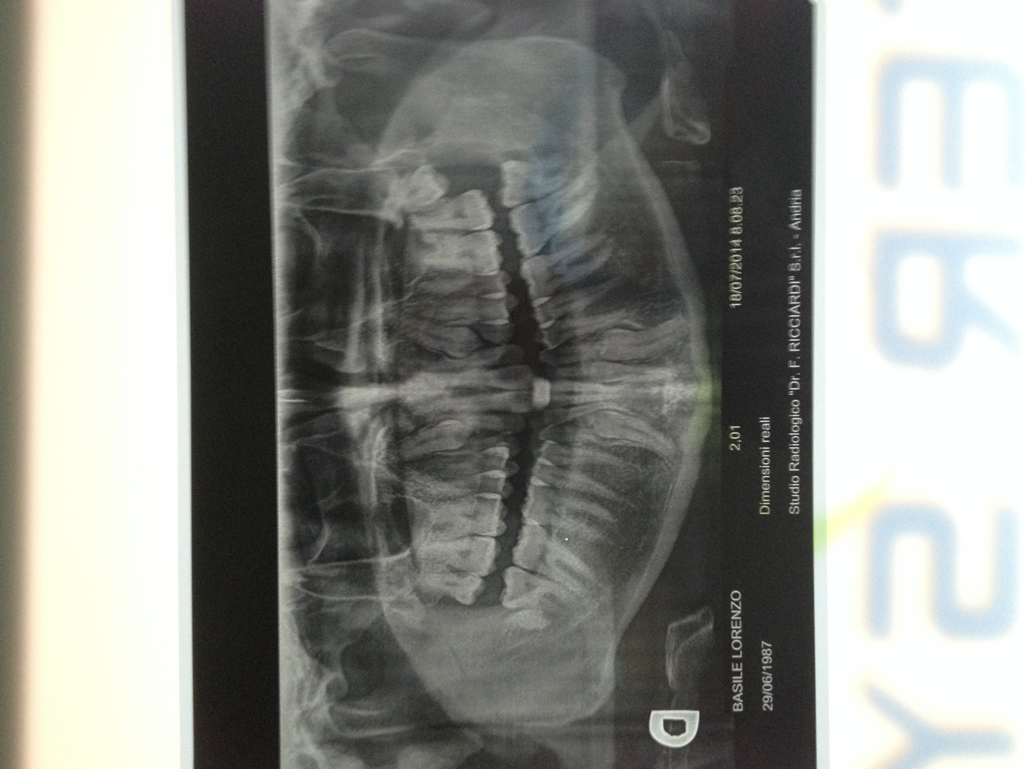 Questo problema di pelle può essere collegato ai denti da latte?