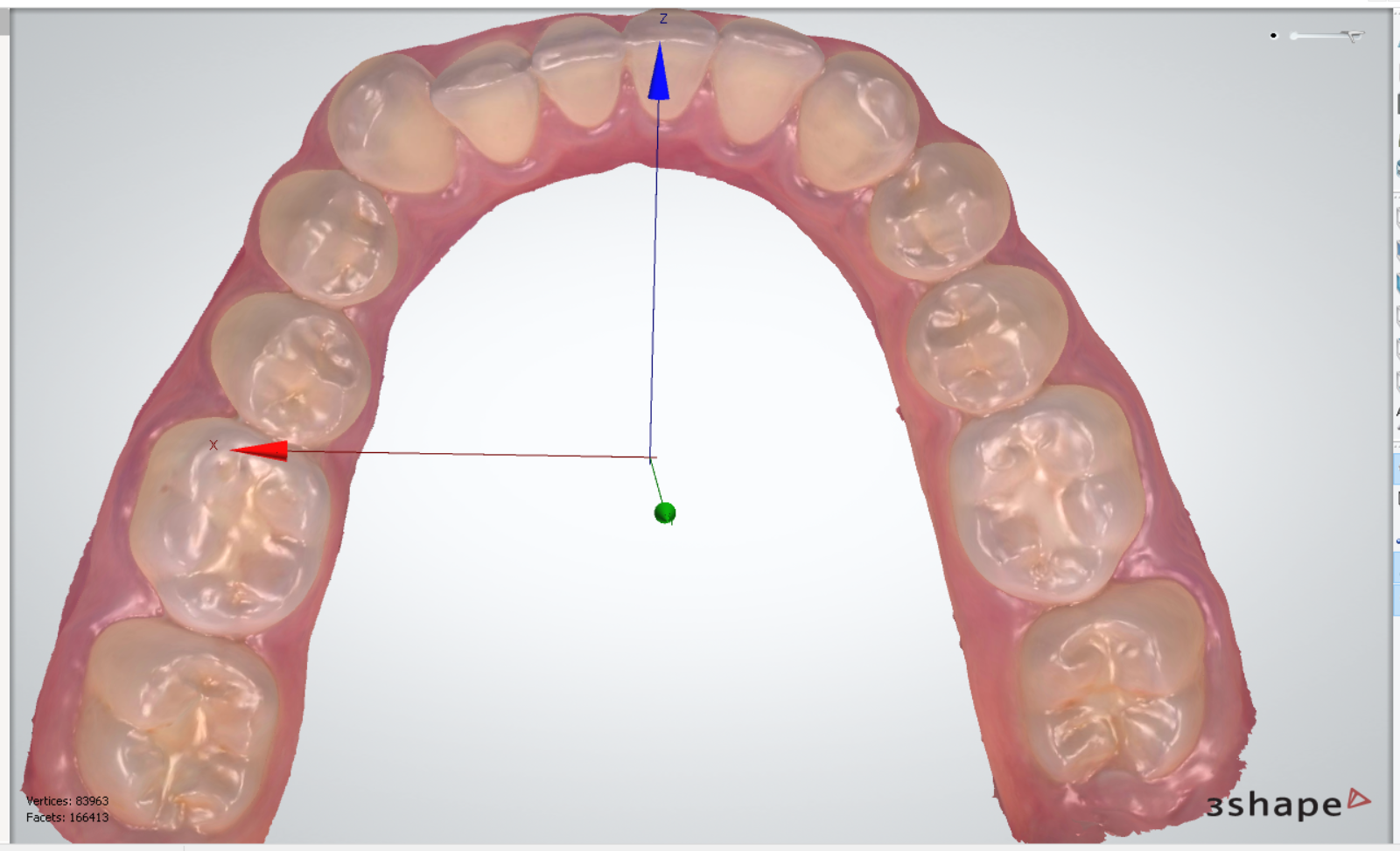 lowerjawscan1.png