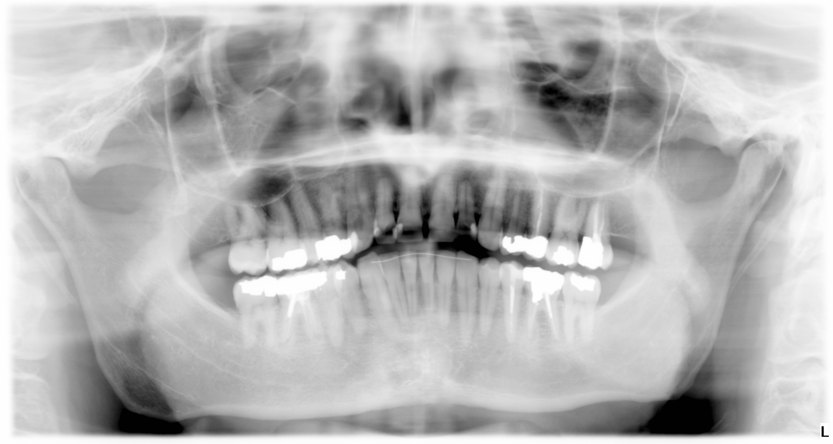 Ho iniziato ad avvertire un dolore diffuso al lato destro della mandibola